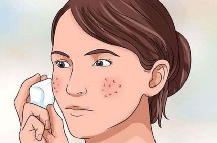 治愈肌肤问题的“小技巧”